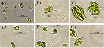 Advanced treatment of secondary effluent from wastewater treatment plant by a newly isolated microalga Desmodesmus sp. SNN1